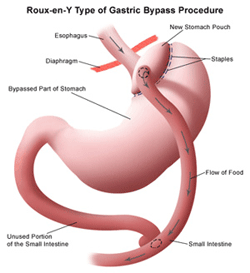 graph of a stomach